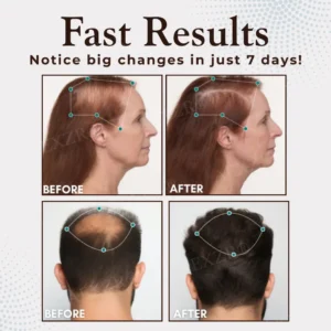 AEXZR® Hair Regrowth Capsules