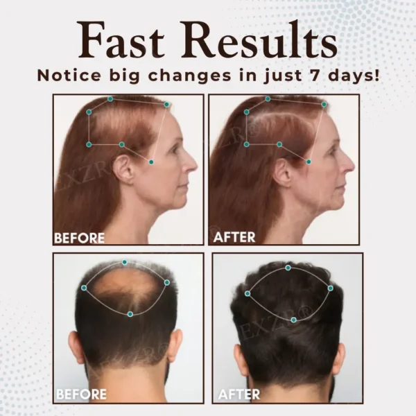 AEXZR® Hair Regrowth Capsules