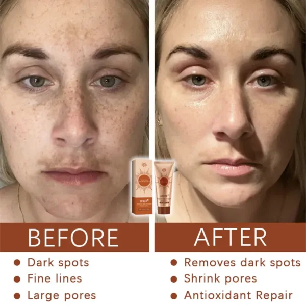 AEXZR® Herbal Spots Peel-Off Facial Mask
